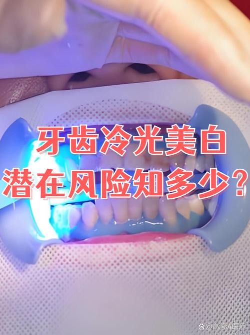 冷光美白的方法有哪些?具体步骤是怎样的?-图3 冷光美白的方法有哪些?具体步骤是怎样的?-图3