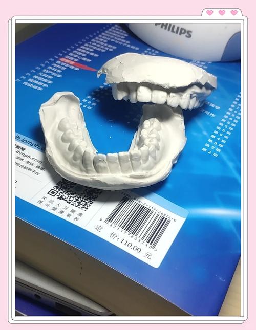 牙模灌石膏方法-图1