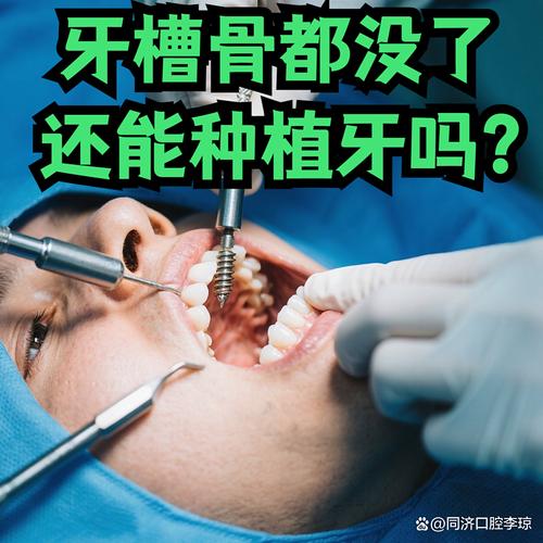 牙骨很少的情况下，种植牙还有机会成功吗？-图1