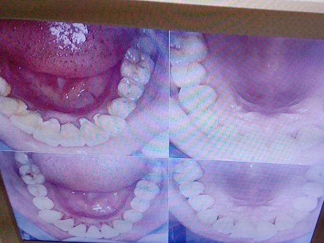 正畸牙医没有给我拍片-图1