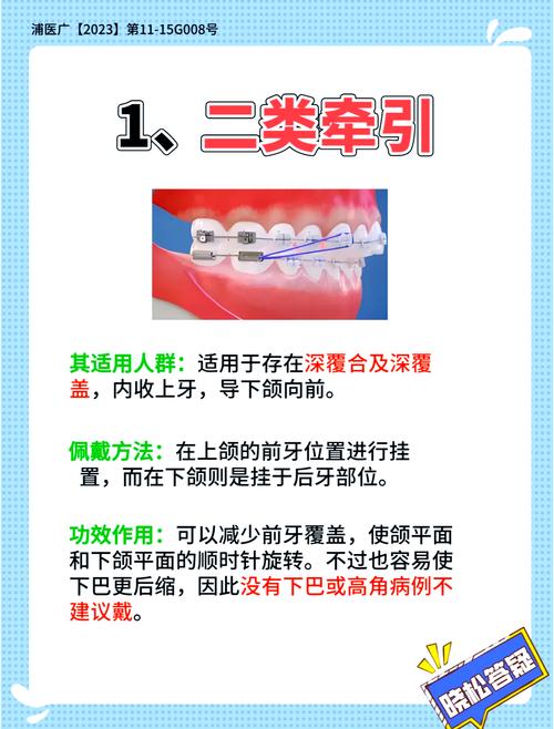 正畸调整中线牵引后头疼是什么原因引起的？-图2