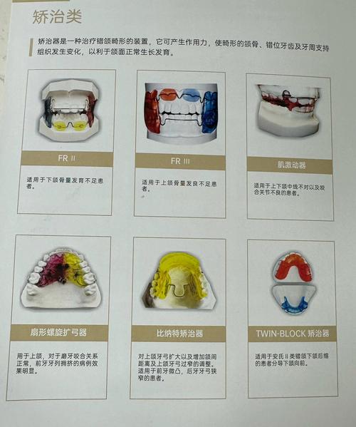 口腔正畸器械图解高清，如何看懂器械分类与用途？-图2