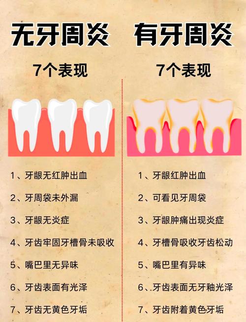 牙周不好不能种牙？背后原因究竟是什么-图2