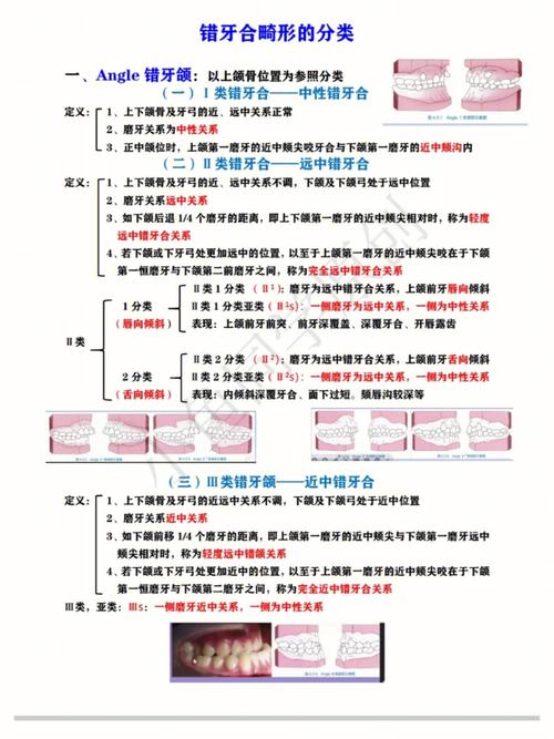正畸中ipr代表什么？这个术语的具体含义是什么？-图3