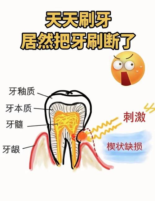 坏牙的处理方法-图3