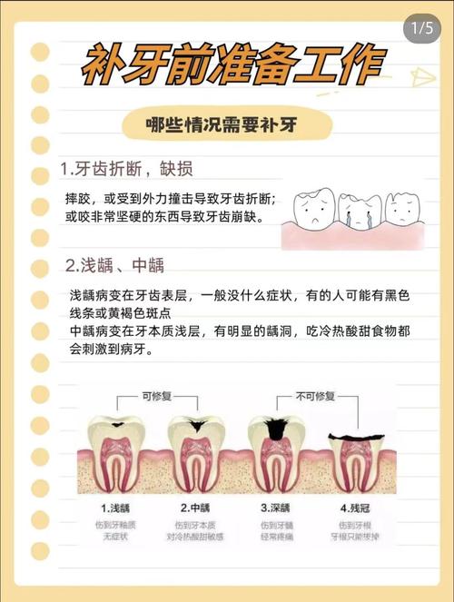 多牙有哪些治疗方法？-图3