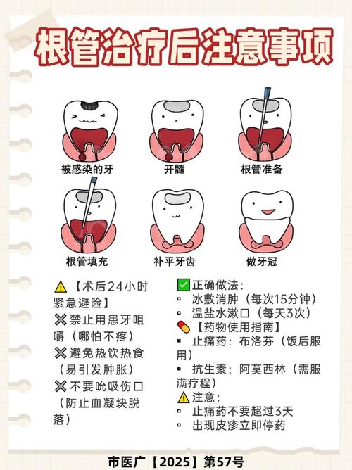 多牙有哪些治疗方法？-图2
