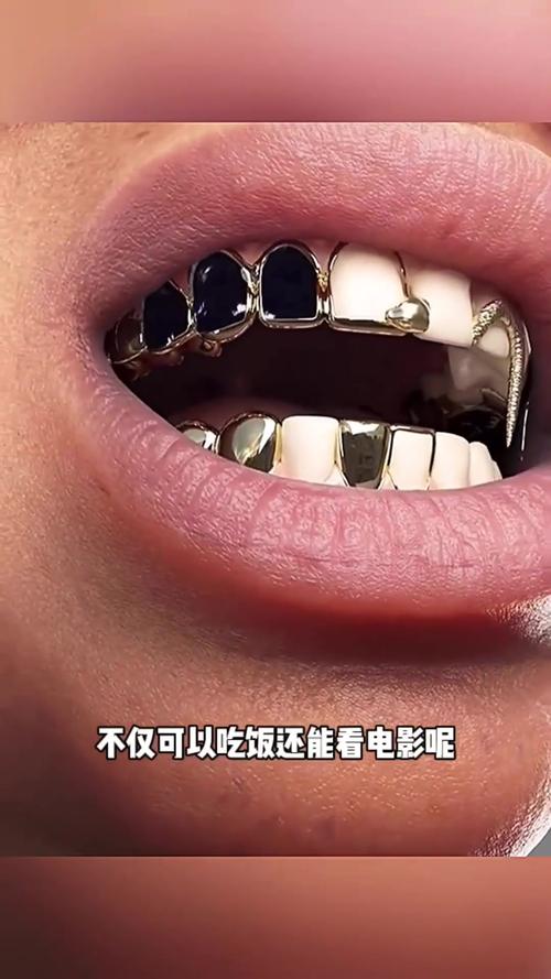 欧美vs韩国种牙，该怎么选？-图2