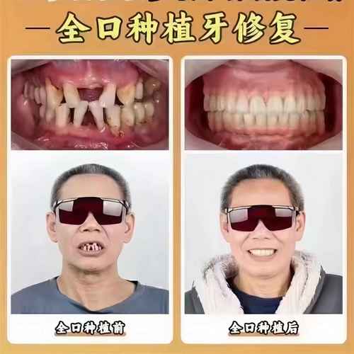 牙博士种牙医生怎么选？专业实力哪家强？-图2