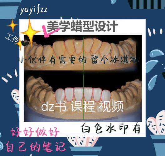 如何精准掌握备牙肩台的操作方法?-图1 如何精准掌握备牙肩台的操作方法?-图1