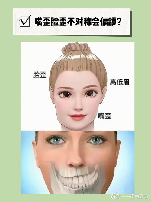 脸型不对称如何矫正？有哪些有效方法推荐？-图2