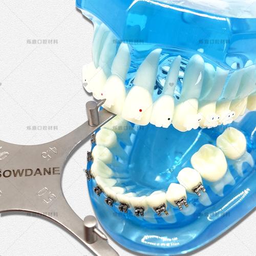 口腔正畸托槽定位模板如何提升矫正精准度？-图2