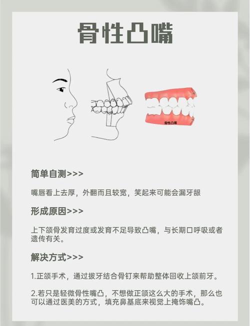 下牙唇倾的矫正方法有哪些？哪种适合不同情况？-图1