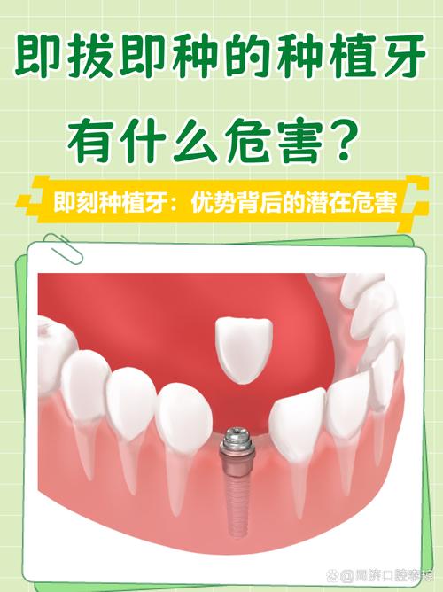 拔牙后种牙，哪种种植方案更合适？-图1
