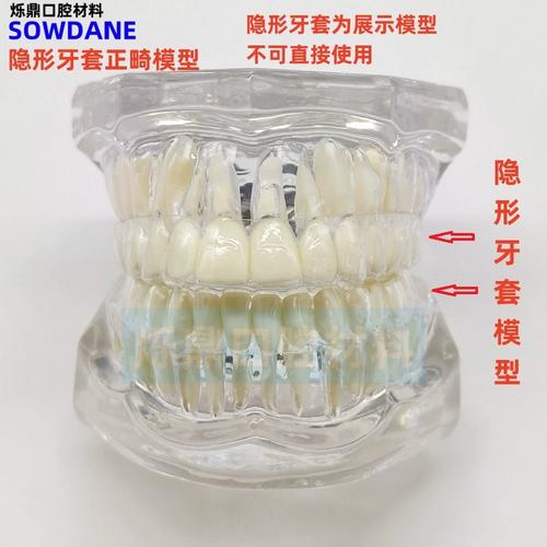 口腔正畸模型制取需满足哪些关键要求？-图1