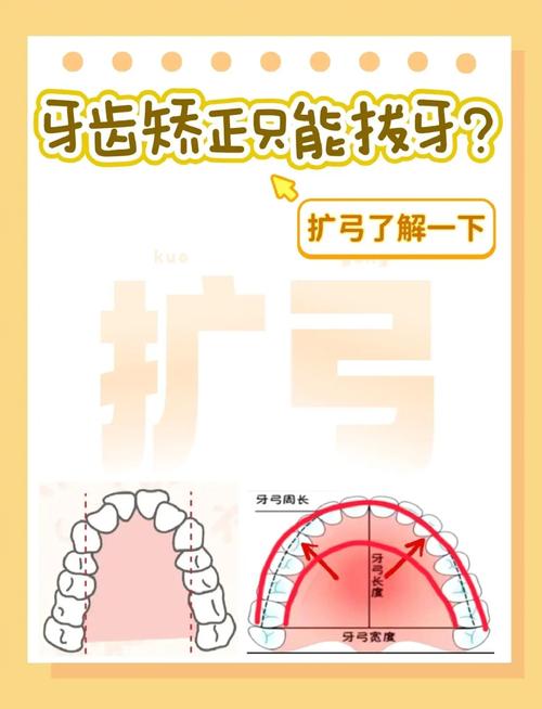 牙科扩弓的常用方法有哪些？-图2