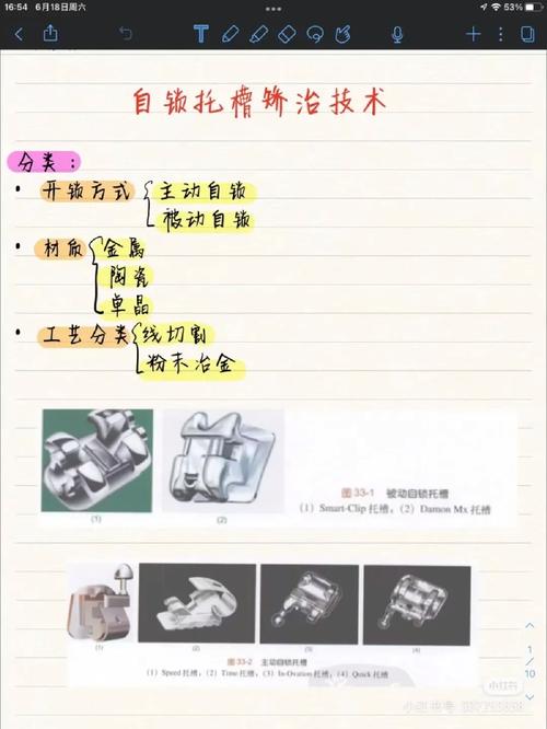 钢托加工方法有哪些？各自优缺点是什么？-图2