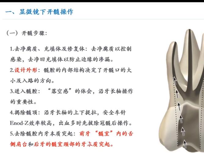 根管预备方法的选择、步骤及操作要点有哪些？-图2