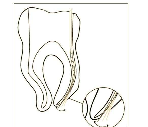 根管预备方法的选择、步骤及操作要点有哪些？-图1