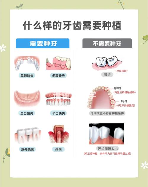 年轻人种牙可以吗？需满足哪些条件？-图2
