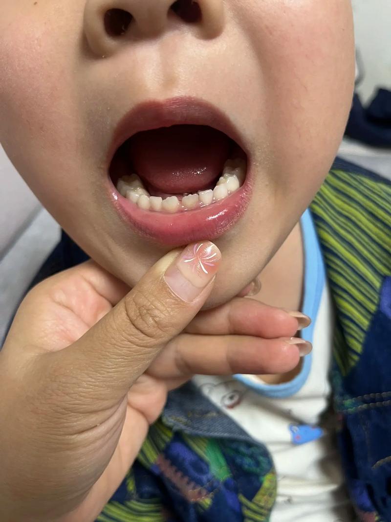 牙医种牙没长出来？是什么原因导致的？-图2