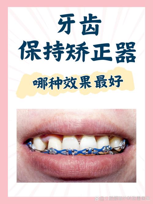 口外正畸牵引的效果真的好吗？-图3