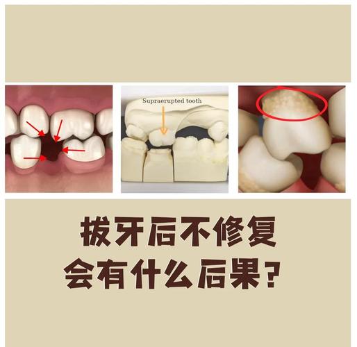 拔牙不种牙可行吗？会有什么影响吗？-图1