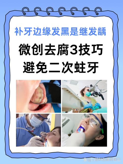 正畸矫正后牙齿发黑，如何有效去除？-图2