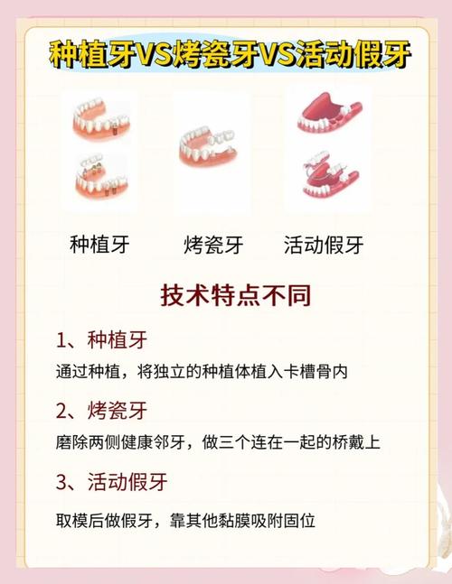 补牙齿几种方法-图3