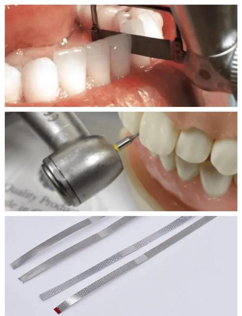 牙合片拍摄的具体操作方法步骤有哪些？-图3