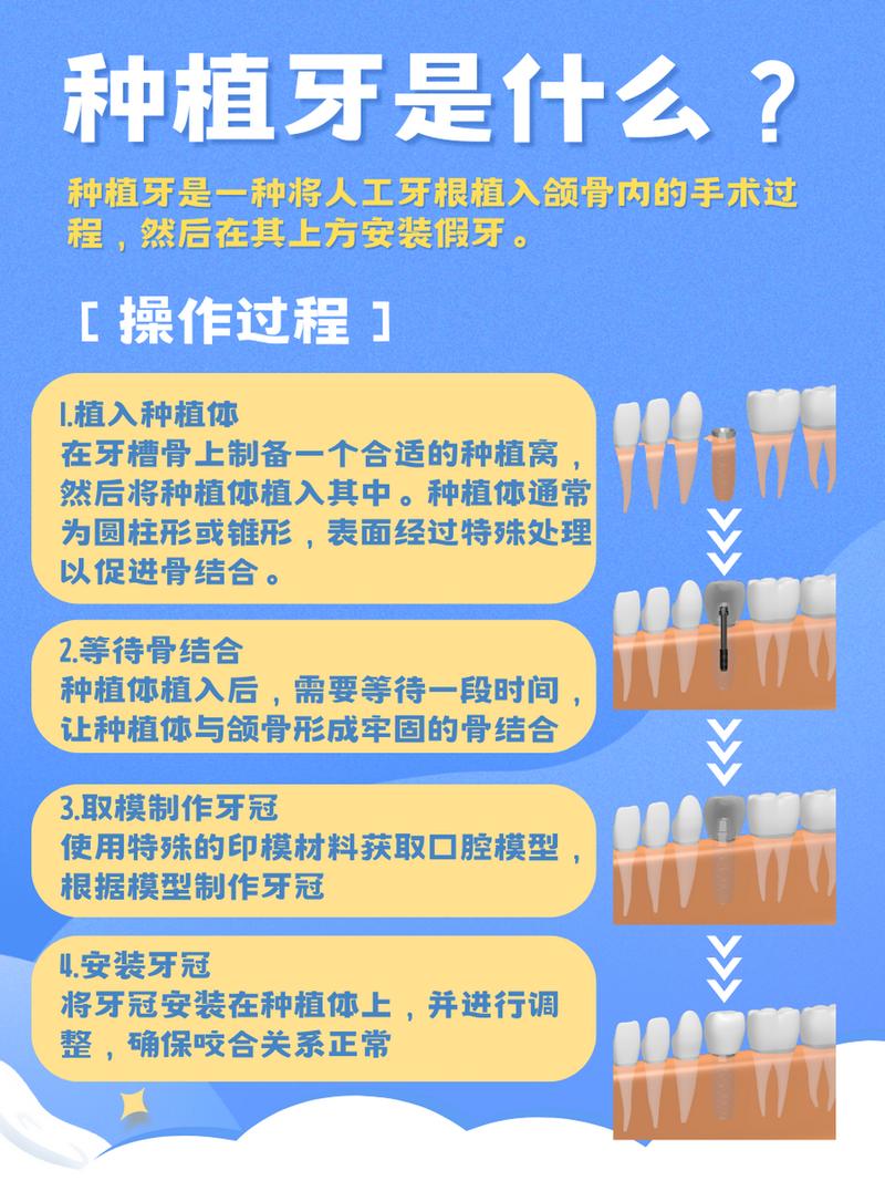 种牙的方式有哪些-图3