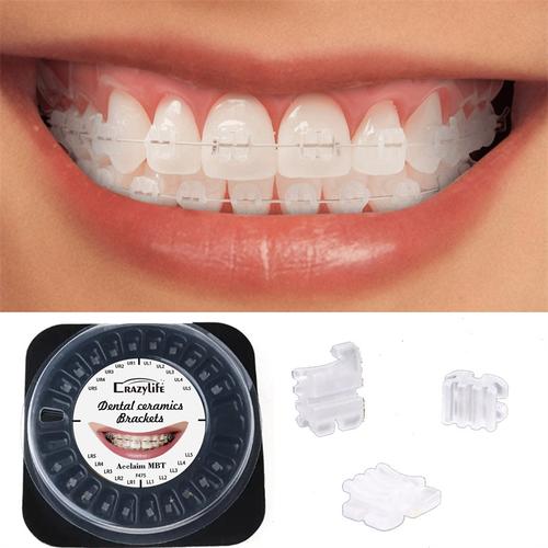 牙科正畸陶瓷托槽价格多少？不同品牌差价大吗？-图2