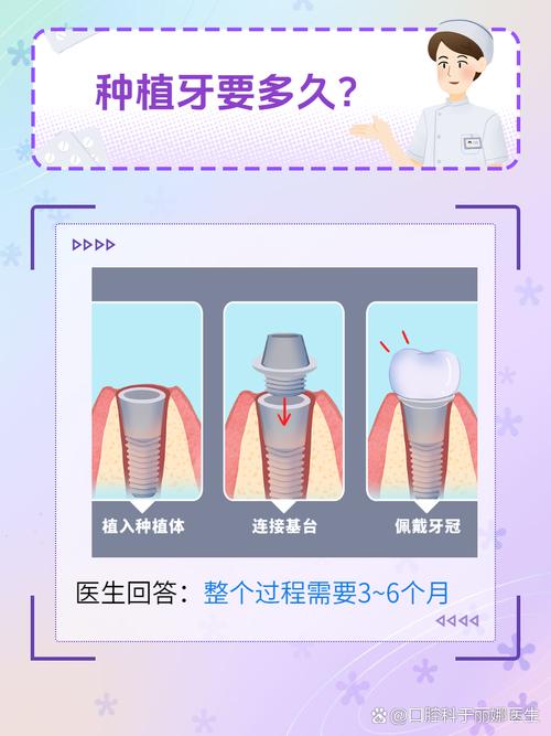 种牙过程中更换医生是否可行？流程复杂吗？-图3