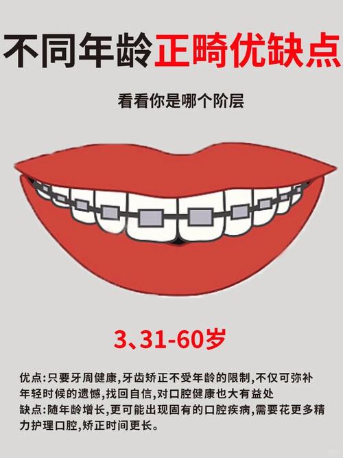 上海小孩牙齿正畸的最佳年龄到底是几岁？-图3