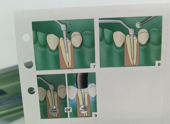 氧化锆粘结方法-图1