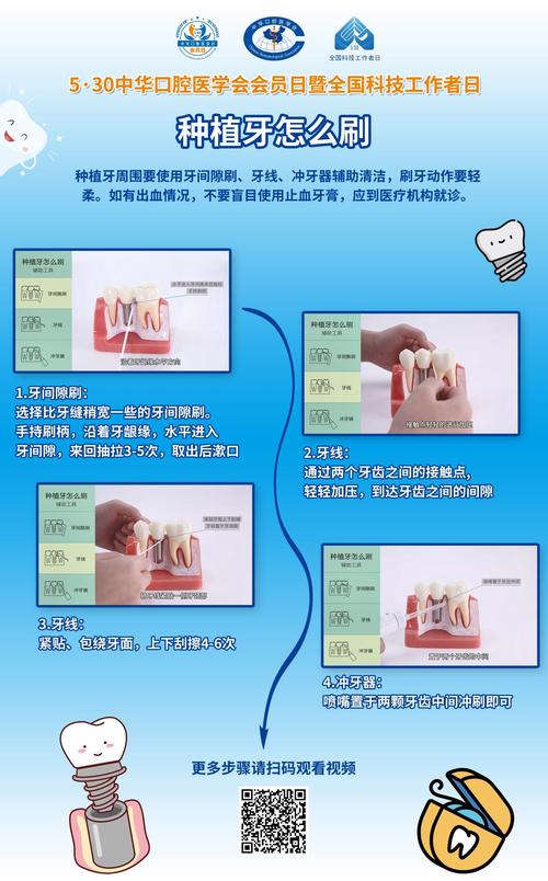 种牙前有哪些关键注意事项需要提前了解和准备？-图3