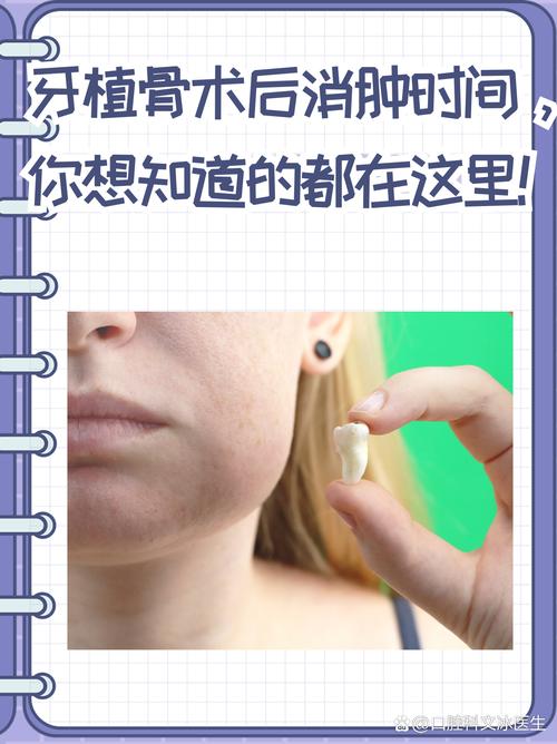 种牙后如何快速消肿？这些方法科学有效吗？-图2