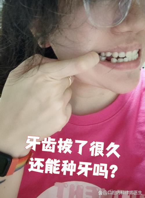 刚拔完牙能种牙吗？即刻种植时机合适吗？-图3