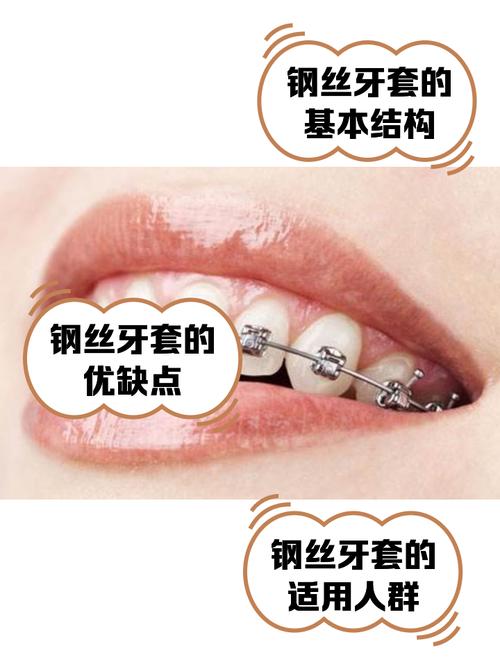 正畸钢丝断了怎么办？正确处理方法是什么？-图2