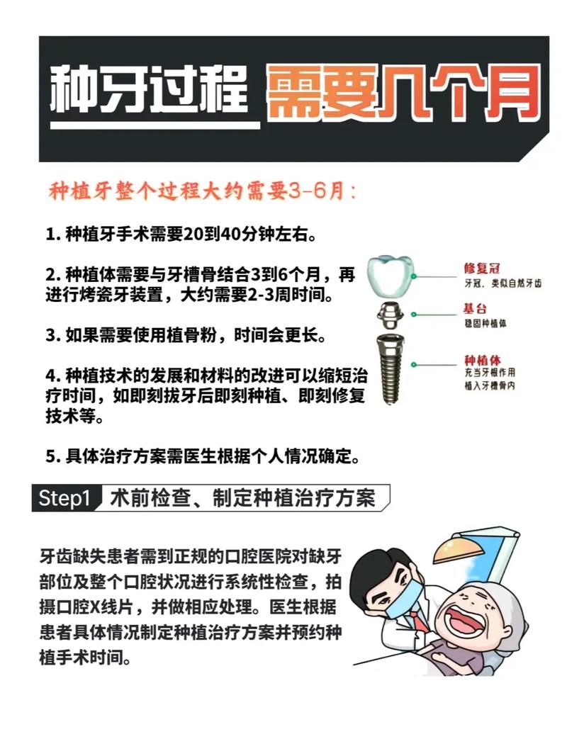 种牙取模一般需要多长时间？-图1