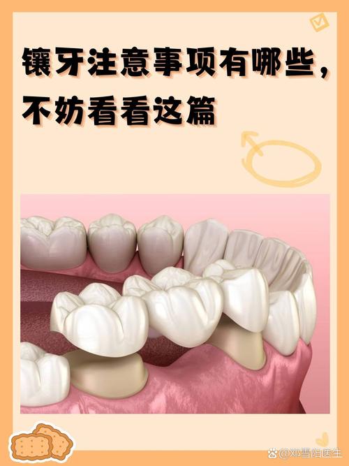 镶牙最便宜的方法有哪些？哪种性价比更高？-图1