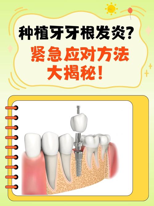 种牙要拔掉牙根吗-图2