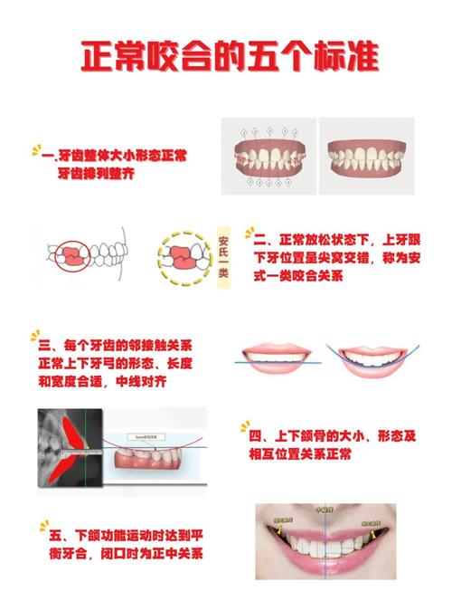咬合检查的方法有哪些具体步骤？-图1