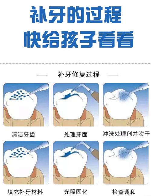 牙齿补洞的方法-图1
