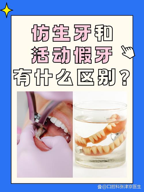 活动义齿还是种牙-图2