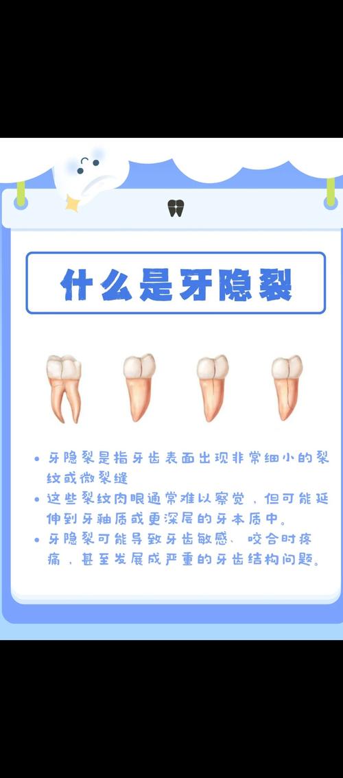 牙齿破损的有效治疗方法有哪些？-图2