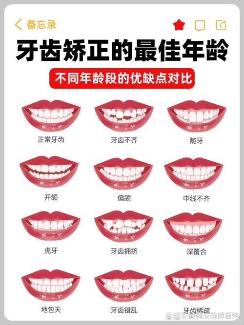 正畸分类方法如何分类？临床应用有何讲究？-图3