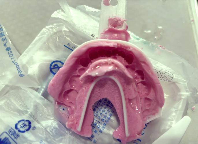 口腔印模材方法-图2