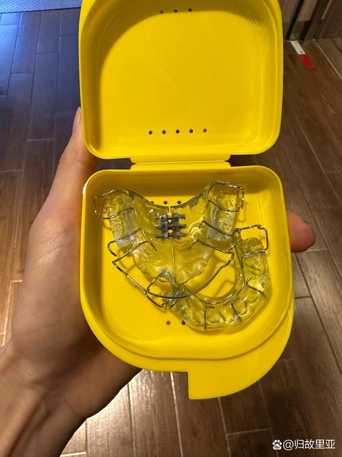 美国case正畸效果如何？值得国内参考借鉴吗？-图1