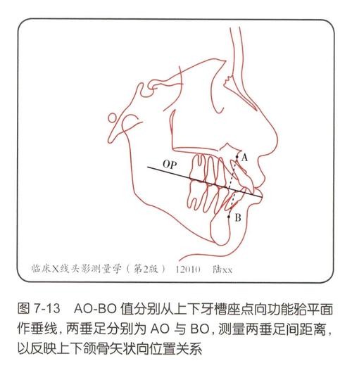 Tweed正畸理论的核心原理与应用价值何在？-图2